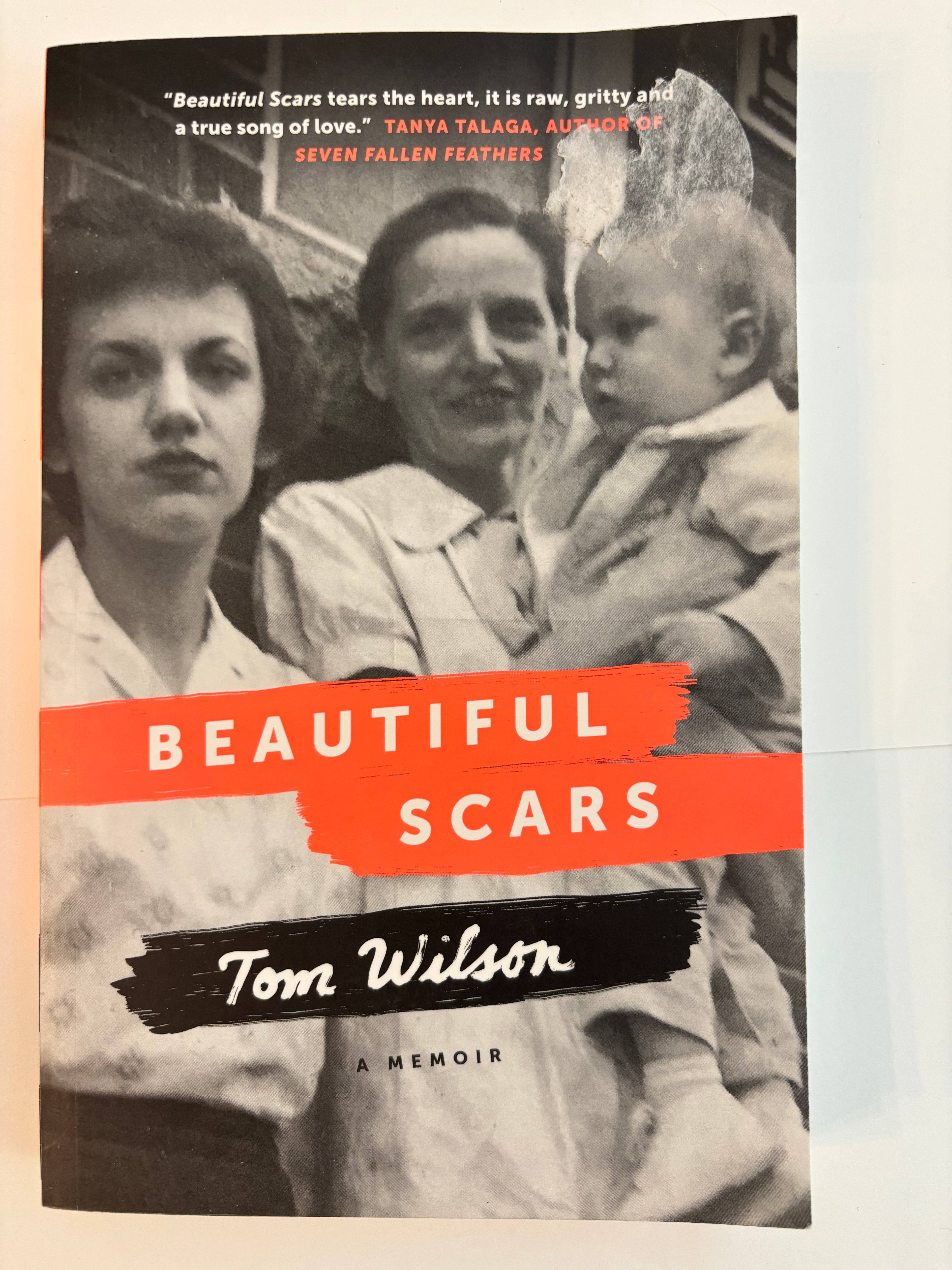 Beautiful Scars - Tom Wilson